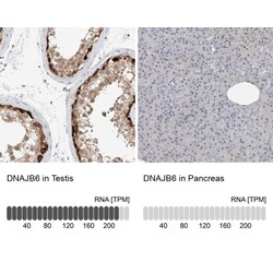 DNAJB6 Antibody, Novus Biologicals 0.1mL; Unlabeled:Antibodies, Polyclonal